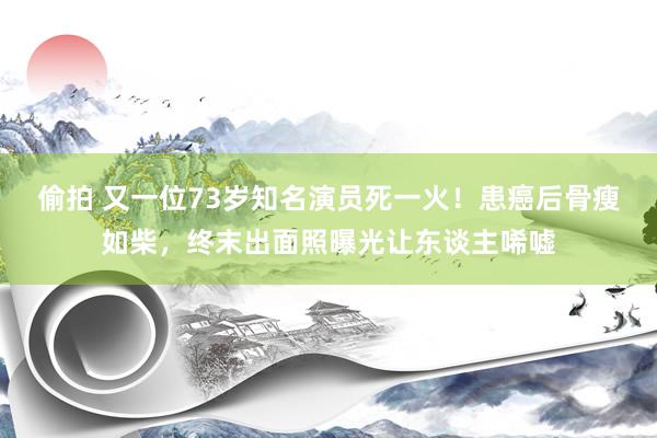 偷拍 又一位73岁知名演员死一火！患癌后骨瘦如柴，终末出面照曝光让东谈主唏嘘